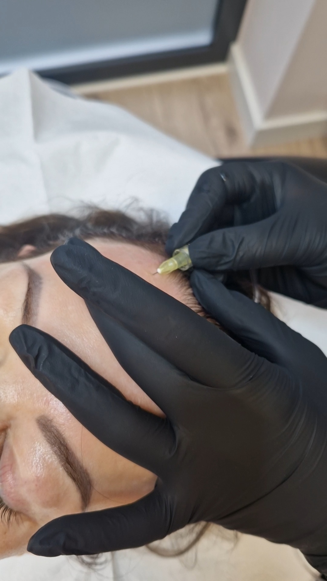 Zdjęcie osoby nakłuwanej podczas zabiegu