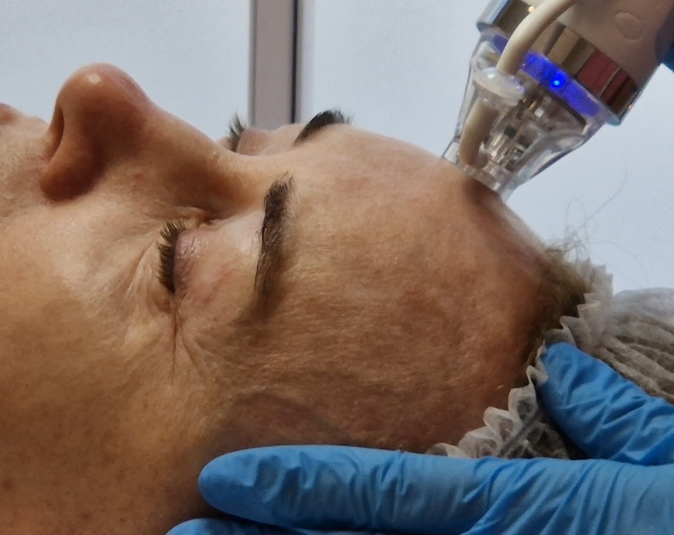 Osoba podczas zabiegu