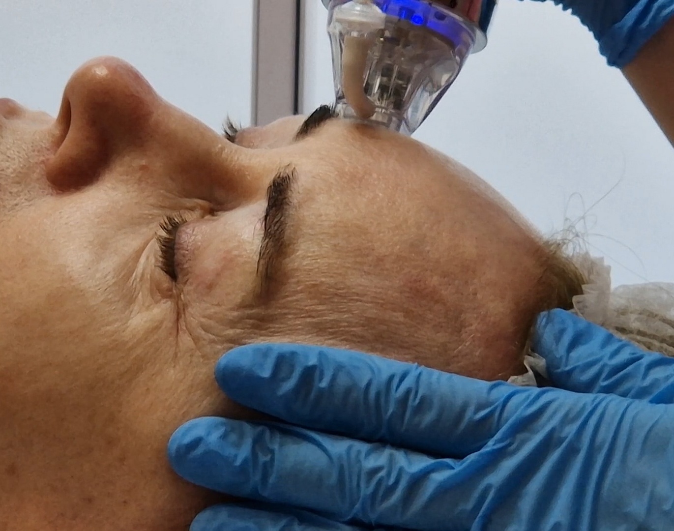 Osoba podczas zabiegu